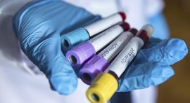 MKE Ankaragücü'nde 5 koronavirüs vakası