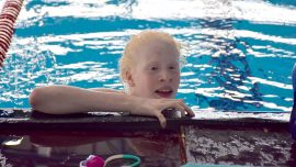 Albino yüzücü Ceren Yergezen'in hedefi Paralimpik Oyunları'na katılmak